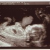 21 Weeks